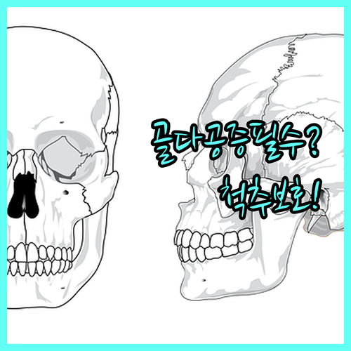 골다공증 환자를 위한 생활 속 척추 보호 스트레칭 방법